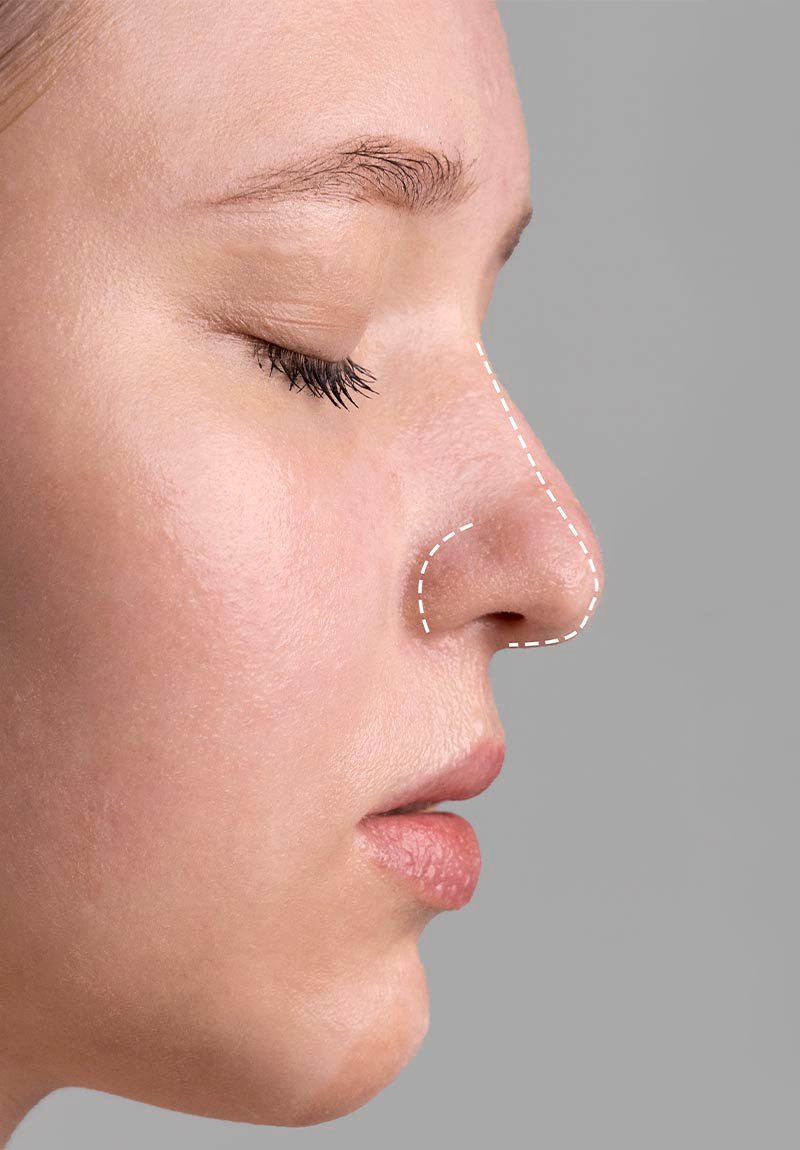 andre-ando-lp-atendimentos-rinoplastia